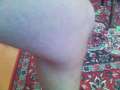 detail foto